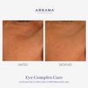 eye-complex-care-Therapy-arkanaspain-ojeras-izquierda-contorno-de-los-ojos-antes-y-despues.jpg