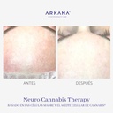 neuro-cannabis-Therapy-arkanaspain-frente-antes-y-después-02.jpg