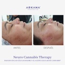 neuro-cannabis-Therapy-arkanaspain-frente-antes-y-después-mejillas-ojos.jpg