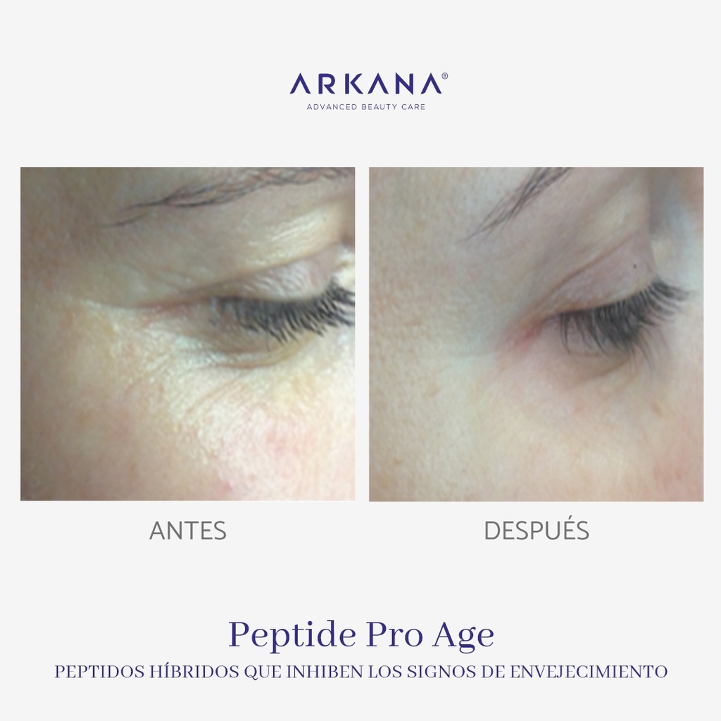 peptide-pro-age-Therapy-arkanaspain-peptidos-hibridos-que-inhiben-los-signos-de-envejecimiento-antes-y-despues-ojos.jpg